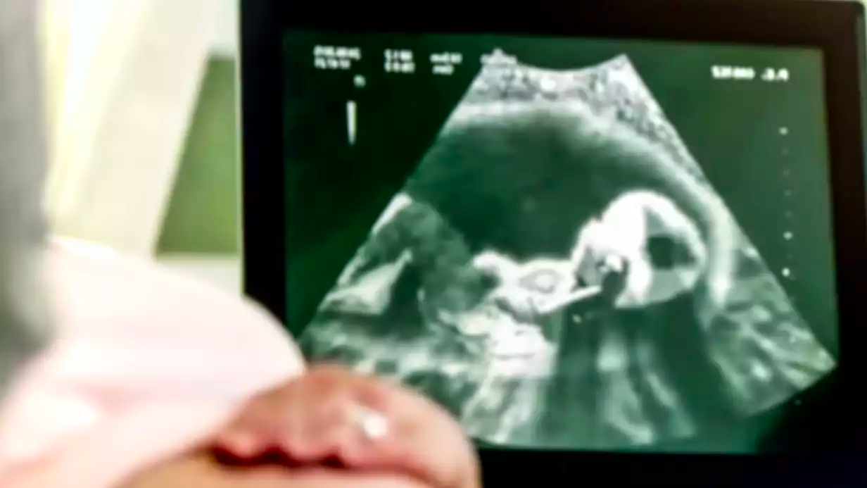 What Do the Terms of Pregnancy Ultrasound Mean?