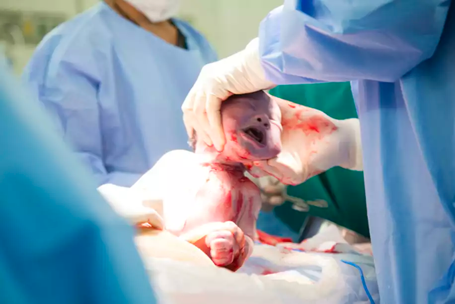 What You Need to Know for Faster Healing of Cesarean Section Scars